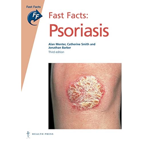 Fast Facts: Psoriais, 3rd edition (Fast Facts series)