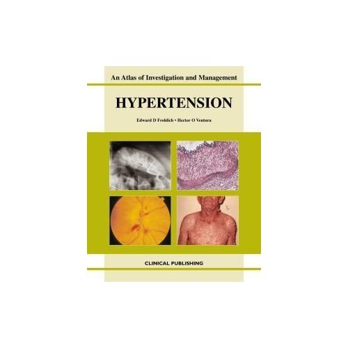 Hypertension (Atlas of Investigation and Management)