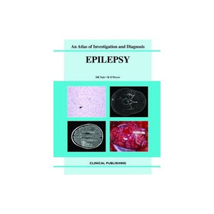 Epilepsy (Atlas of Investigation and Management)