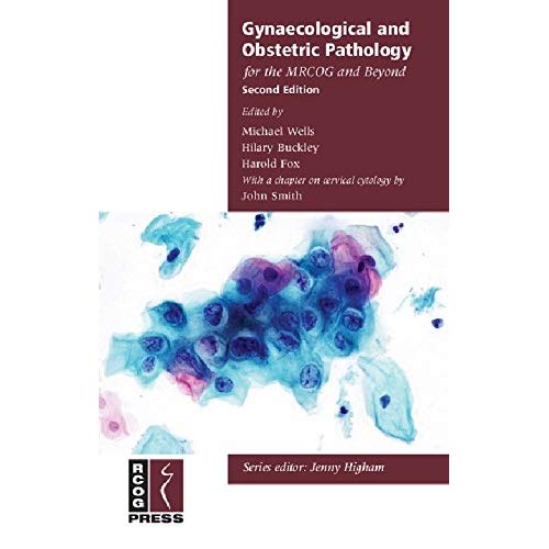 Gynaecological and Obstetric Pathology for the MRCOG and Beyond (Membership of the Royal College of Obstetricians and Gynaecologists and Beyond)