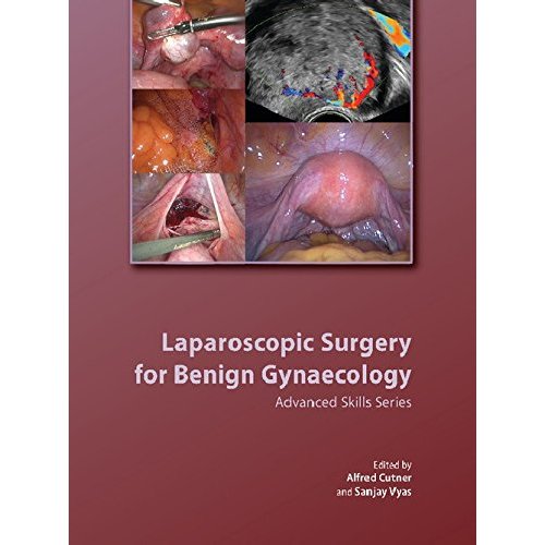 Laparoscopic Surgery for Benign Gynaecology Hardback with DVDs (Royal College of Obstetricians and Gynaecologists Advanced Skills)