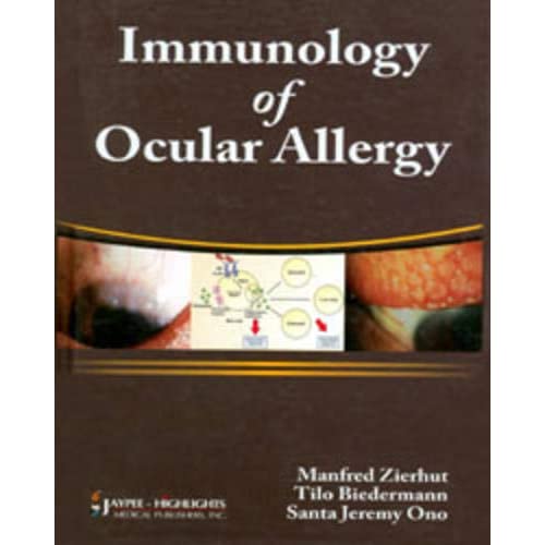 Immunology of Ocular Allergy