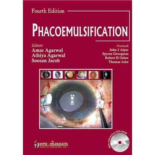Phacoemulisification 4/E