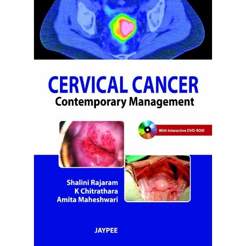 Cervical Cancer: Contemporary Management