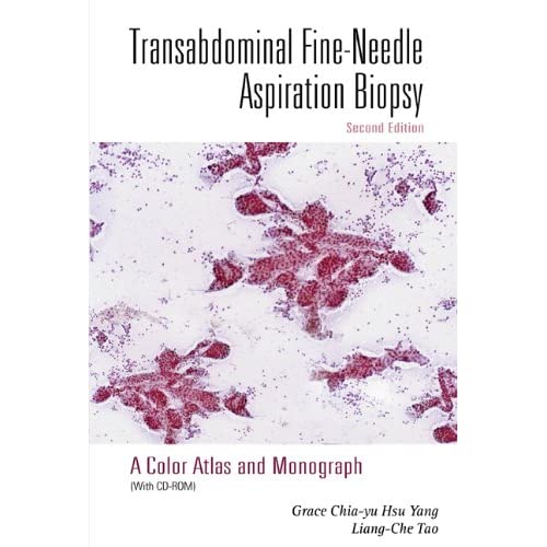 Transabdominal Fine-Needle Aspiration Biopsy (2nd Edition): A Color Atlas and Monograph (With Cd-Rom)